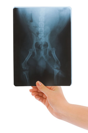 X-ray in hand isolated on white backgroundの写真素材
