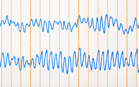 Electro cardiogram ecg - medical background