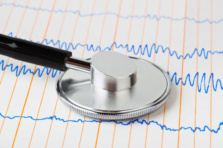 Stethoscope on ecg - medical background