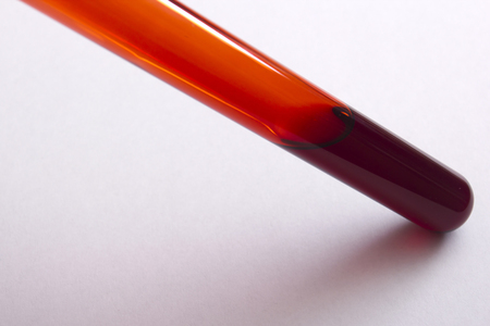 Test tubes filled with blood to analyze doping or AIDS.の写真素材