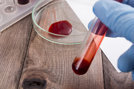 Tubes of blood  the analysis on the presence of contaminants, disease or dopingの写真素材