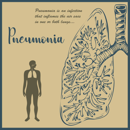 Illustration of awareness of Pneumonia is an infection that inflames the air sacs in one or both lungs.のイラスト素材