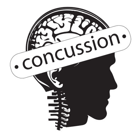 Human concussion symbol, isolated on white background. Vector illustration.のイラスト素材