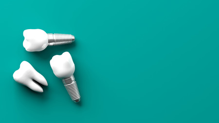Tooth and dental implants isolated on green background. 3d illustration