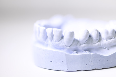 dental dentist objects implants