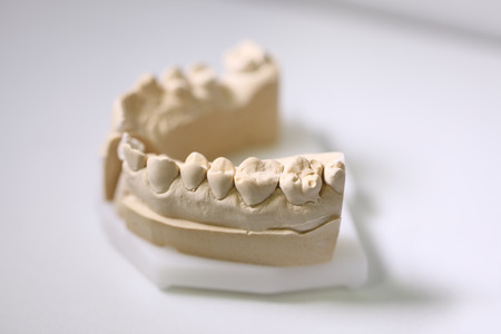 dental dentist objects implantsの写真素材
