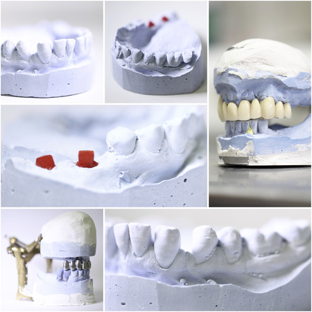 composition collage dental dentist objects implants