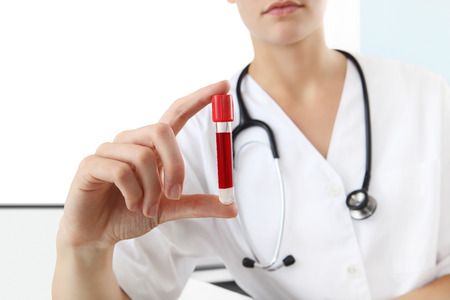 hands doctor holding test tube with blood. close upの写真素材