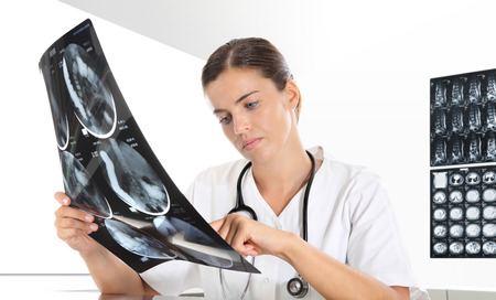 Radiologist woman checking xray. healthcare, medical and radiology concept