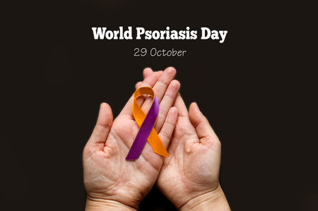 World Psoriasis Day. Woman's hands are holding a purple-orange ribbon on a black background. Treatment of skin diseases, dermatitis, eczema, psoriasis. medical bannerの写真素材