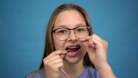 Girl with braces brushing your teeth with dental floss. A girl with colored braces on her teeth...