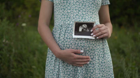 A young pregnant woman holds an ultrasound picture of a baby in her hands. Girl in a dress outdoors.