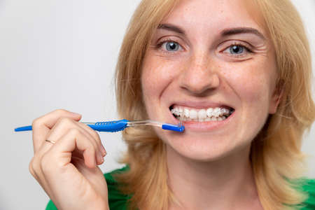 Close-up of a smiling woman face with braces on white teeth and toothbrush.の写真素材