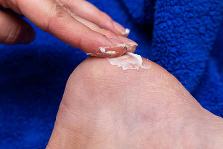 applying cream on the feet sole for the treatment of corn, callus, callosity, cracks, softening the skin, cosmetic proceduresの写真素材