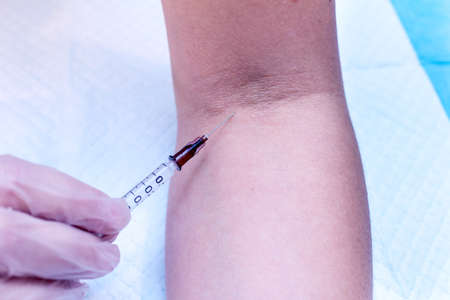 syringe injection process in a hand close up