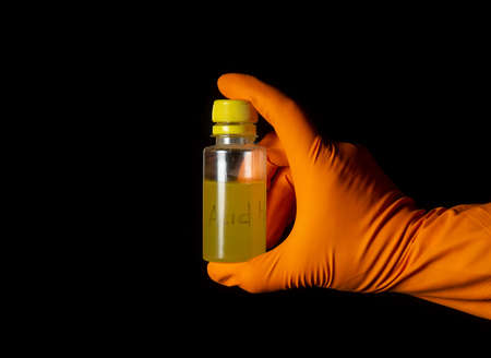 Person chemist holds test tube of glass in his hand with acid. Mixing chemicals for experimentの写真素材