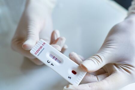 Doctor hands in gloves holding lab card kit test for viral disease COVID-19, 2019-nCoV. Test showing positive result. Diagnosis of coronavirus.の写真素材