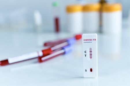 Tests for COVID-19 with positive result, lab card kit test for viral influenza. test tubes containing a blood sample on background. Testing for presence of coronavirus.の写真素材