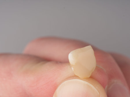 A tooth pulled out in his hand. Closeupの写真素材