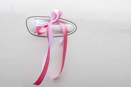 festive ribbon on the carの写真素材