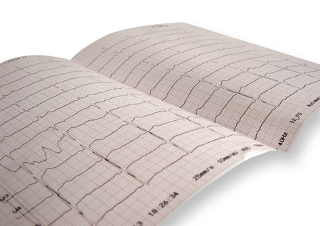 cardiogram isolated on whiteの写真素材