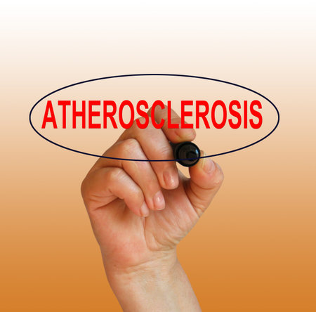 writing word atherosclerosis with marker on gradient background made in 2d software
