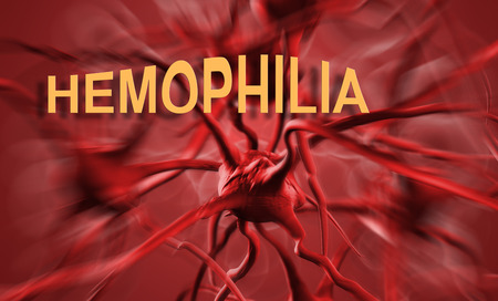 The word Hemophilia   representing the blood disorder or disease that affects people who cannot form clots to close woundsの写真素材
