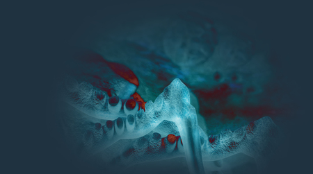 Digital 3d illustration of cancer cells in human bodyの写真素材