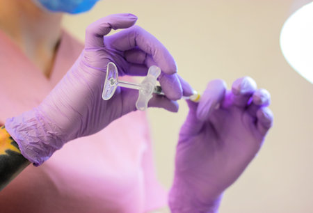 A beautician in a protective mask, pink medical gown, purple gloves holding a syringe in hands. Woman's beauty injections, cosmetology, health, medicine. Facial rejuvenation. Lip augmentation. Surgeryの写真素材