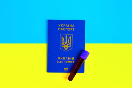 A test tube with blood on a passport against the background of the flag of Ukraine.