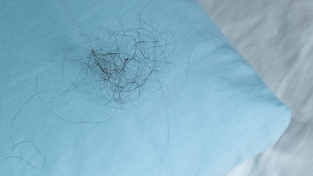 Fallen long hair on the blue pillow. Baldness and hair loss problemの写真素材