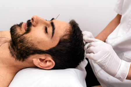 Stock photo of unrecognized worker doing acupuncture procedure to male client.