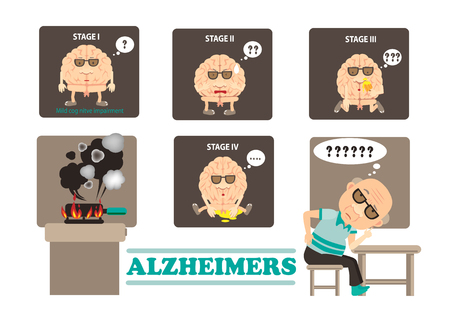 Stages of Alzheimer's disease infographics vector illustrationのイラスト素材