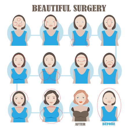 Women unattractive surgery a perfect of before after. Info Graphic. vectorのイラスト素材