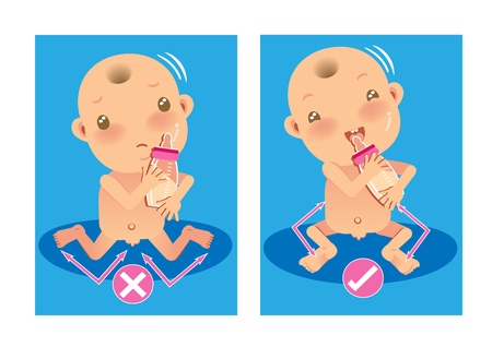 Baby right and wrong ways sitting position for child, stop W sitting position.Cartoon vector illustrationのイラスト素材