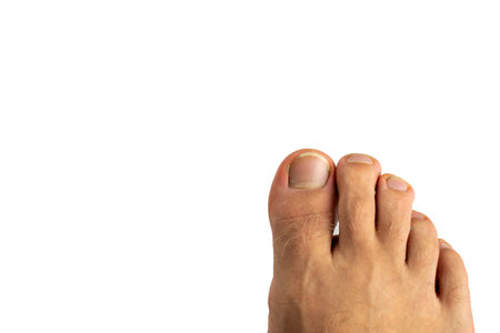 Male foot on a white isolated background. Toes with long nailsの写真素材