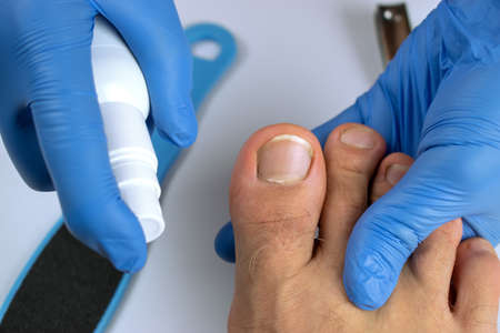 The pedicure master applies the spray to the client's foot.の写真素材