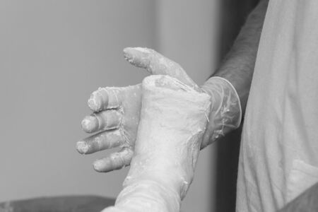 close-up hand of a doctor holding the right leg of a child in a cast. bwの写真素材