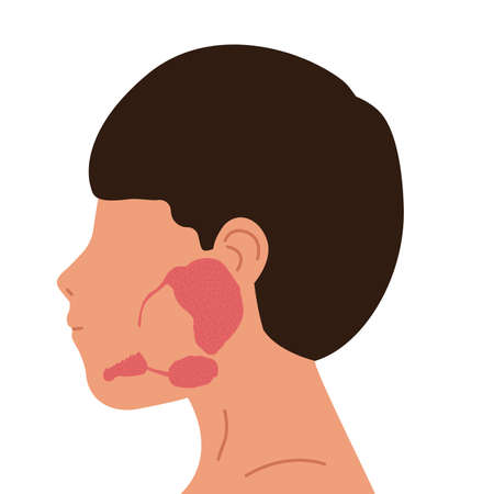 Person and salivary glands, parotid, submandibular and sublingual glands. Medical vector illustration.のイラスト素材
