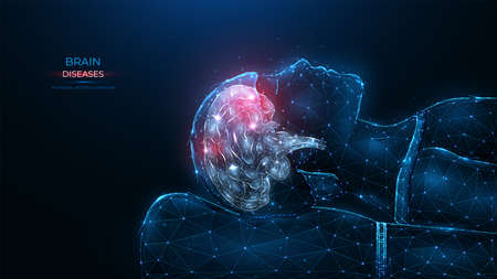 Polygonal vector illustration of human brain disease on a dark blue background. Inflammation of the patient's cerebrum, injury or inflammatory foci of the brain. Neurology template or bannerのイラスト素材