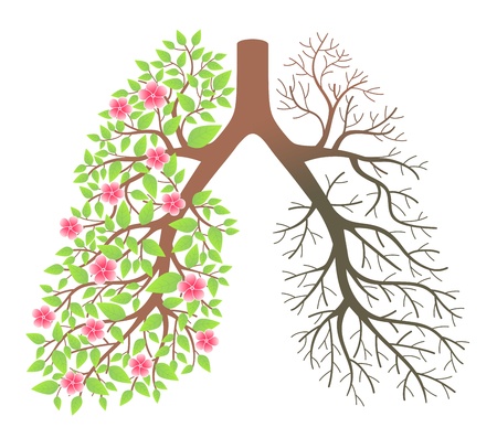 Lungs  Effect after smoking and diseaseのイラスト素材