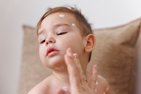 Mother spreading ointment on toddler boy's chickenpox spots to prevent itching and scratchingの写真素材