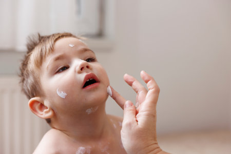 Mother spreading ointment on toddler boy's chickenpox spots to prevent itching and scratchingの写真素材
