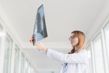 Young female doctor looking at the x-ray picture of lungs in hospitalの写真素材