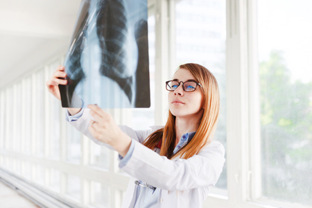 Young female doctor looking at the x-ray picture of lungs in hospitalの写真素材