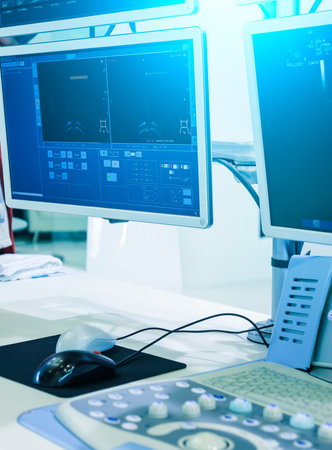 Ultrasound machine in the modern operating laboratory.