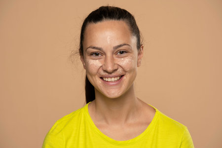 Closeup of young smiling woman with concealer on her face on a beige background
