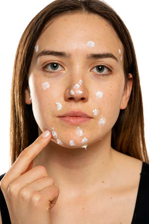 Woman applying acne cream on her face for solving acne inflammation on her face on a white backgroundの写真素材