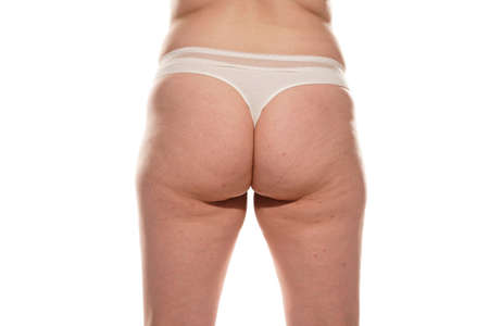 Overweight woman with fat cellulite legs and buttocks, obesity female body, white background.の写真素材