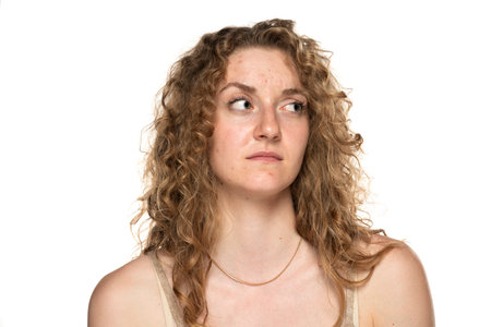 doubtful young blond women with long curly hair and problematic skin.の写真素材